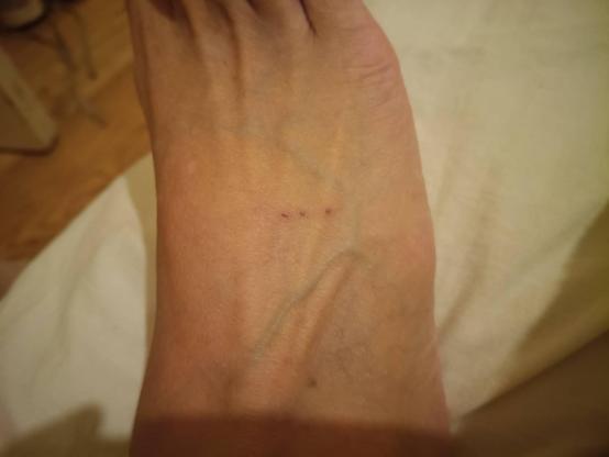 3 linear dots on foot.